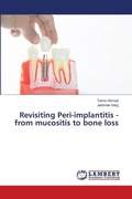 Cover: Revisiting Peri-implantitis - from mucositis to bone loss - LAP Lambert Academic Publishing