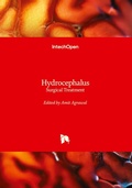 Cover: Hydrocephalus - IntechOpen