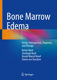 Abbildung von: Bone Marrow Edema - Springer