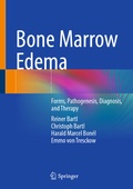 Cover: Bone Marrow Edema - Springer