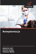 Cover: Reimplantacja - Wydawnictwo Nasza Wiedza