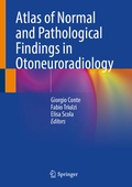Abbildung von: Atlas of Normal and Pathological Findings in Otoneuroradiology - Springer