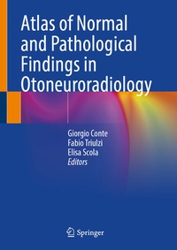 Abbildung von: Atlas of Normal and Pathological Findings in Otoneuroradiology - Springer