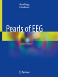 Abbildung von: Pearls of EEG - Springer