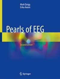 Abbildung von: Pearls of EEG - Springer