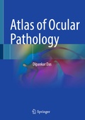 Cover: Atlas of Ocular Pathology - Springer