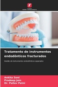 Cover: Tratamento de instrumentos endodonticos fracturados - Edicoes Nosso Conhecimento
