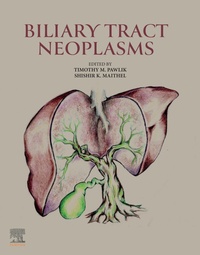 Abbildung von: Biliary Tract Neoplasms - Elsevier