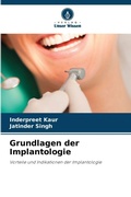 Cover: Grundlagen der Implantologie - Verlag Unser Wissen