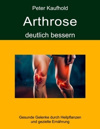 Abbildung von: Arthrose deutlich bessern - BoD - Books on Demand