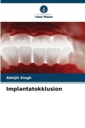 Cover: Implantatokklusion - Verlag Unser Wissen