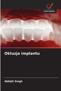 Cover: Okluzja implantu - Wydawnictwo Nasza Wiedza