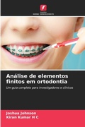 Cover: Analise de elementos finitos em ortodontia - Edicoes Nosso Conhecimento
