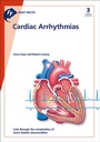 Cover: Fast Facts: Cardiac Arrhythmias - Health Press Limited