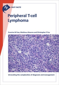 Enlarge image Cover: Fast Facts: Peripheral T-cell Lymphoma - Health Press Limited