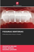 Cover: Fissuras Dentarias - Edicoes Nosso Conhecimento