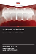 Cover: Fissures Dentaires - Editions Notre Savoir