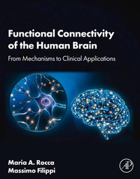 Abbildung von: Functional Connectivity of the Human Brain - Elsevier