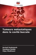 Cover: Tumeurs metastatiques dans la cavite buccale - Editions Notre Savoir