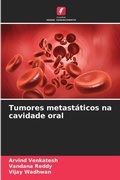 Cover: Tumores metastaticos na cavidade oral - Edicoes Nosso Conhecimento