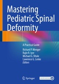 Cover: Mastering Pediatric Spinal Deformity - Springer