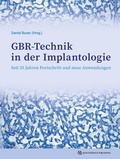 Bild: GBR-Technik in der Implantologie - Quintessenz Verlag
