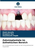 Cover: Zahnimplantate im aesthetischen Bereich - Verlag Unser Wissen