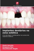 Cover: Implantes dentarios na zona estetica - Edicoes Nosso Conhecimento