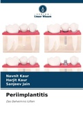 Cover: Periimplantitis - Verlag Unser Wissen