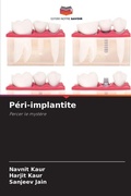 Cover: Peri-implantite - Editions Notre Savoir