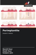 Cover: Perimplantite - Edizioni Sapienza