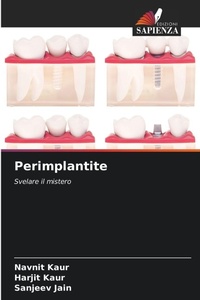 Enlarge image Cover: Perimplantite - Edizioni Sapienza