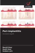 Cover: Peri-implantitis - Wydawnictwo Nasza Wiedza