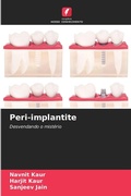 Cover: Peri-implantite - Edicoes Nosso Conhecimento