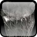 Cover: Oxford Textbook of Rheumatology - Oxford University Press, USA
