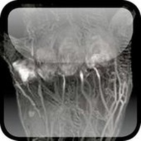 Enlarge image Cover: Oxford Textbook of Rheumatology - Oxford University Press, USA