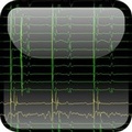 Cover: Mayo Clinic Electrophysiology Manual - Oxford University Press, USA