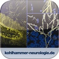 Cover: Therapie und Verlauf neurologischer Erkrankungen - Kohlhammer