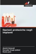 Cover: Opzioni protesiche negli impianti - Edizioni Sapienza