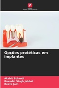 Cover: Opcoes proteticas em implantes - Edicoes Nosso Conhecimento