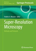 Cover: Super-Resolution Microscopy - Humana