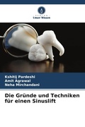 Cover: Die Gruende und Techniken fuer einen Sinuslift - Verlag Unser Wissen