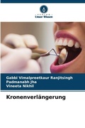 Cover: Kronenverlaengerung - Verlag Unser Wissen