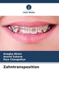 Cover: Zahntransposition - Verlag Unser Wissen