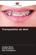 Cover: Transposition de dent - Editions Notre Savoir