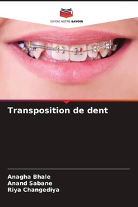 Enlarge image Cover: Transposition de dent - Editions Notre Savoir