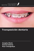 Cover: Transposici&oacute;n dentaria - Ediciones Nuestro Conocimiento