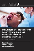 Cover: Influencia del tratamiento de ortodoncia en las ra&iacute;ces de dientes autotrasplantados - Ediciones Nuestro Conocimiento