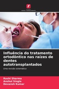 Cover: Influencia do tratamento ortodontico nas raizes de dentes autotransplantados - Edicoes Nosso Conhecimento