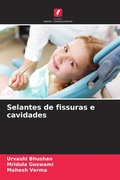 Cover: Selantes de fissuras e cavidades - Edicoes Nosso Conhecimento